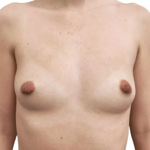 Image before