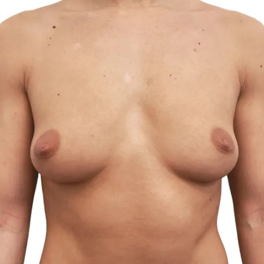 Image before