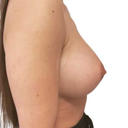 Image after