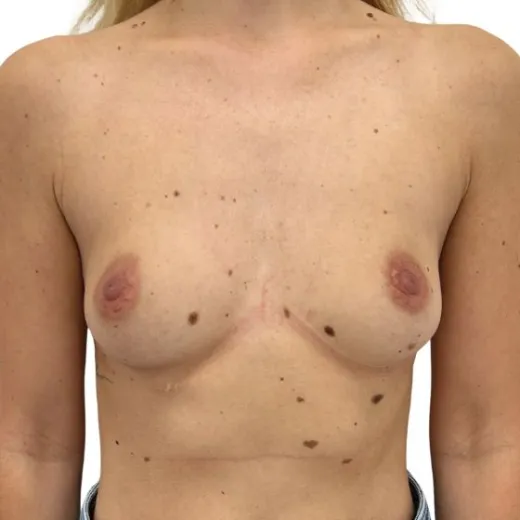 Image before