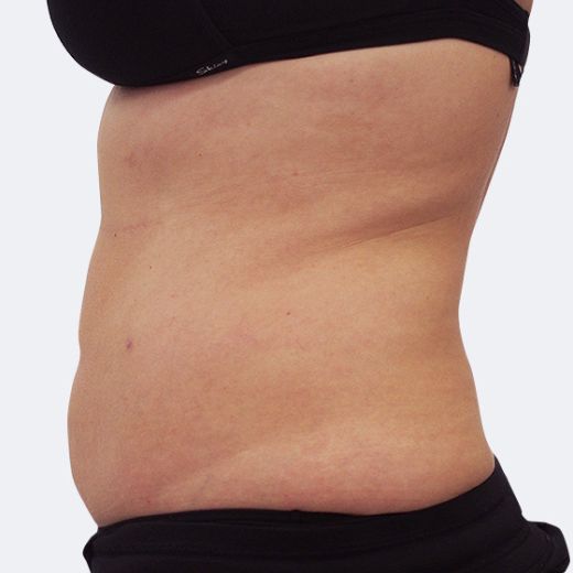 Image after