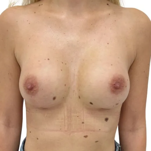 Image after