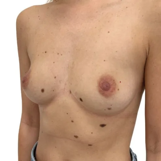 Image before