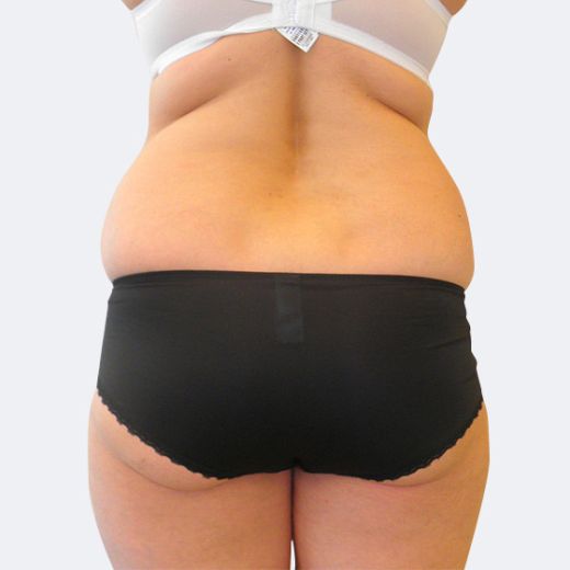 Image before