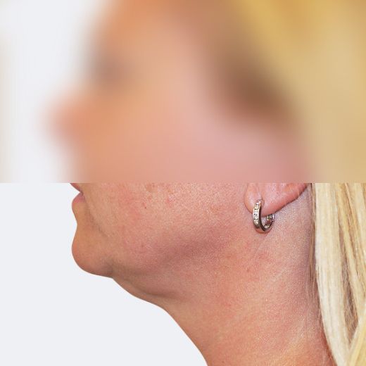Image after