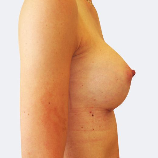 Image after
