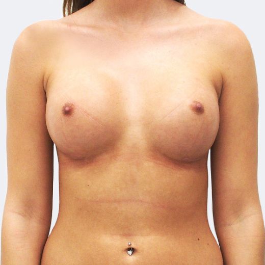 Image after