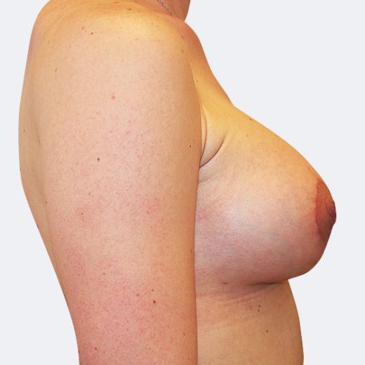 Image after
