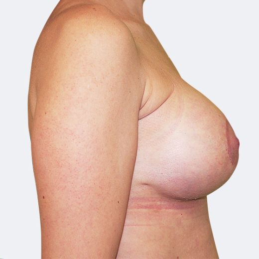 Image after