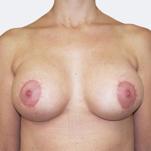 Image after