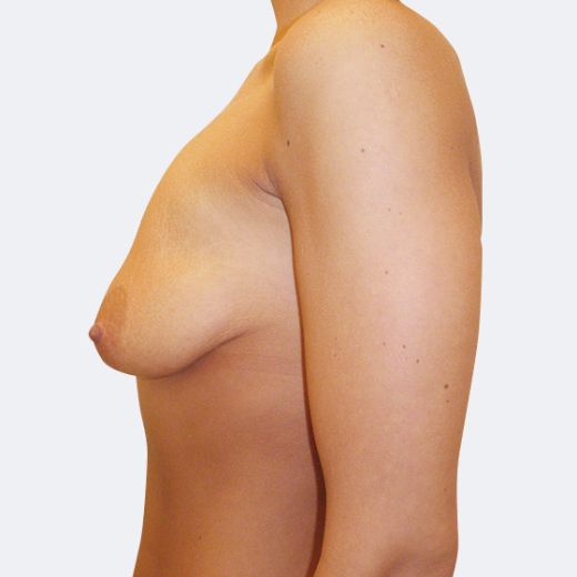 Image before