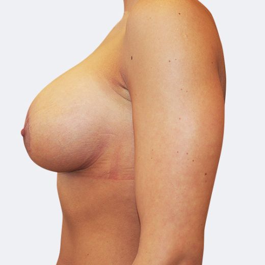 Image after