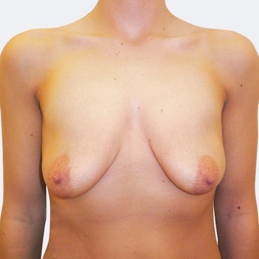 Image before