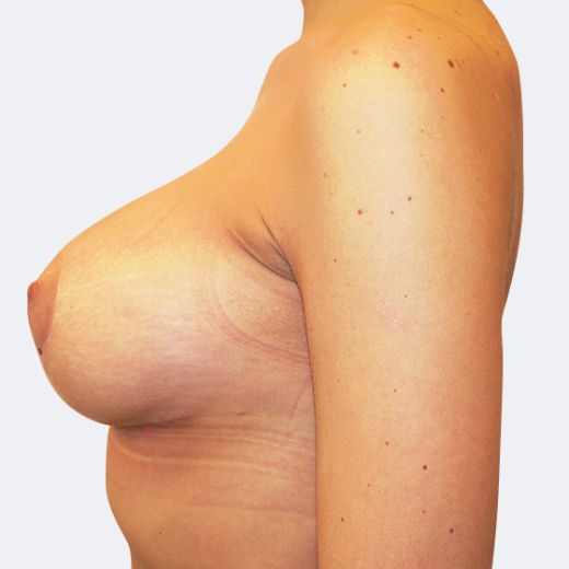 Image after