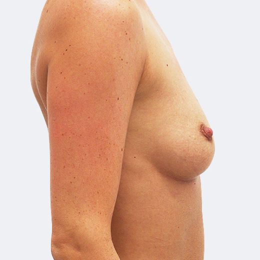Image before