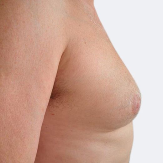 Image before