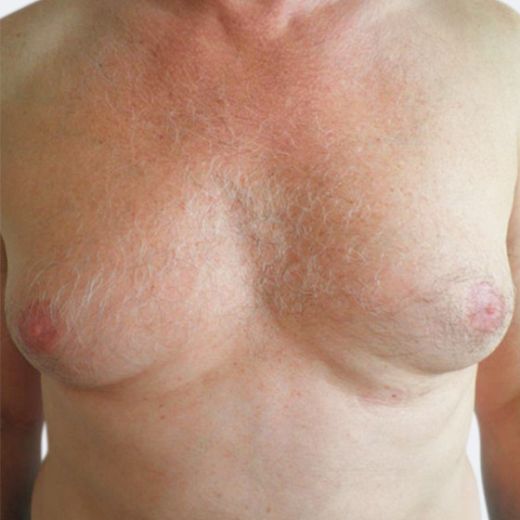 Image before