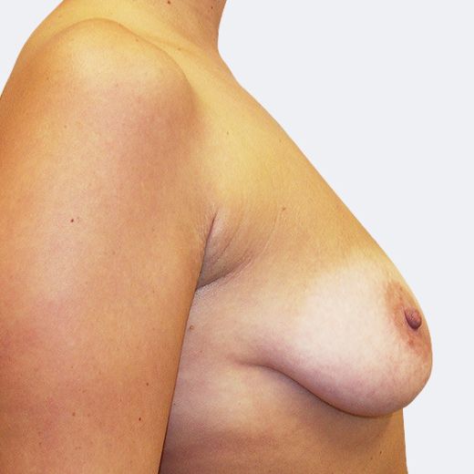 Image before