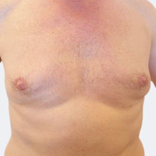 Image after