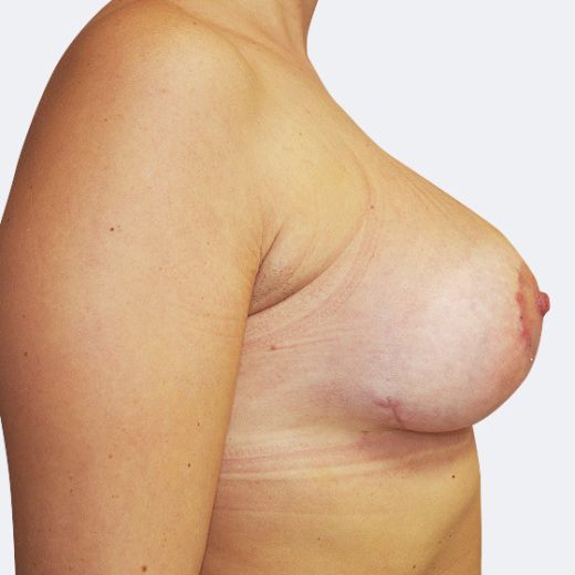 Image after