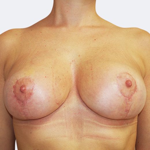 Image after