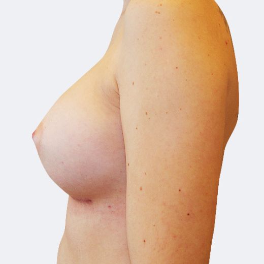 Image after