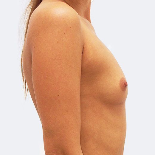 Image before