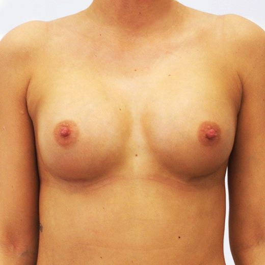 Image after