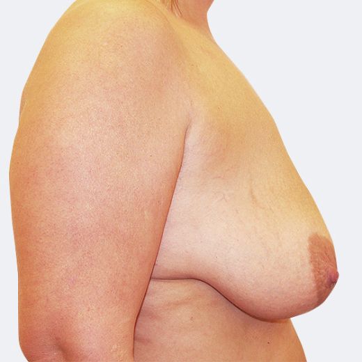 Image before