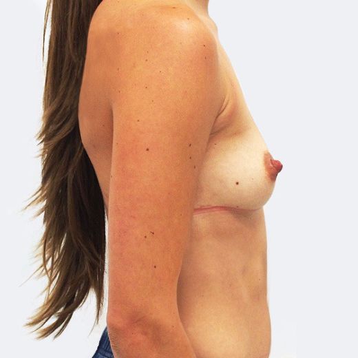 Image before