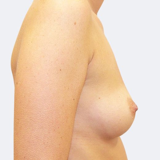 Image before
