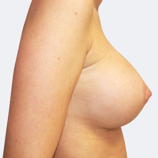 Image after