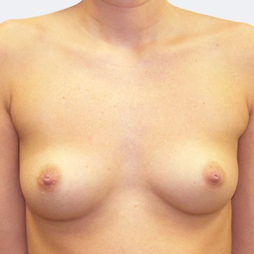 Image before