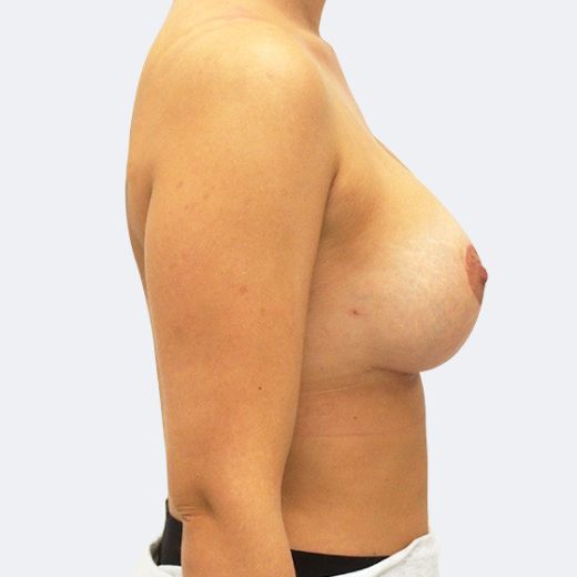 Image after