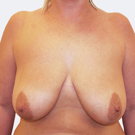 Image before