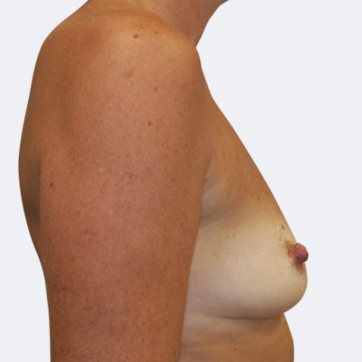 Image before
