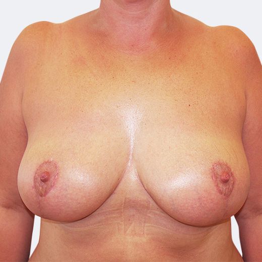 Image after