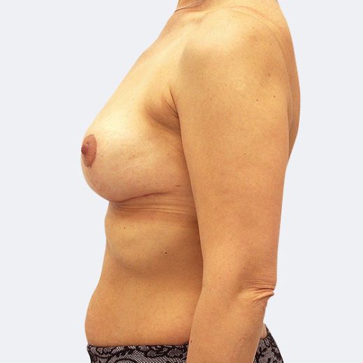 Image after