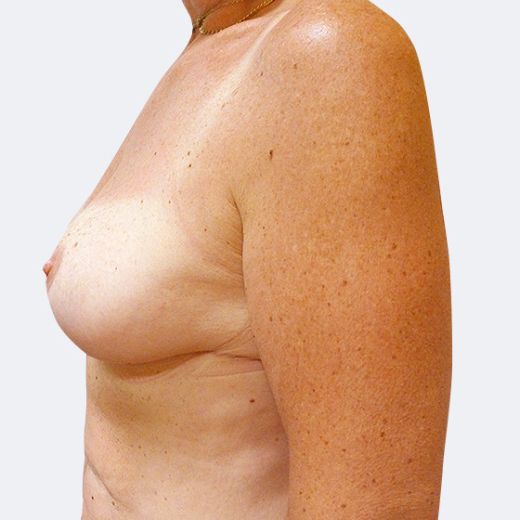 Image after