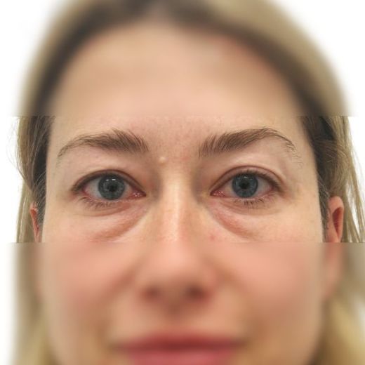 Image before