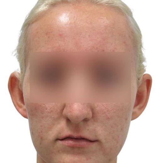 Image before