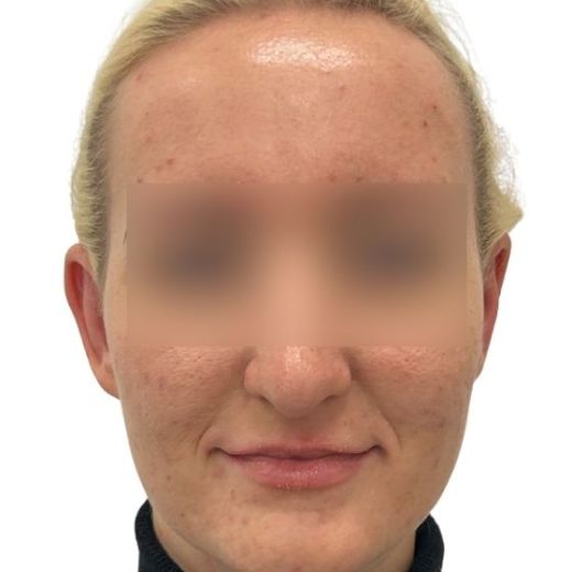 Image after