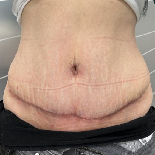 Image after