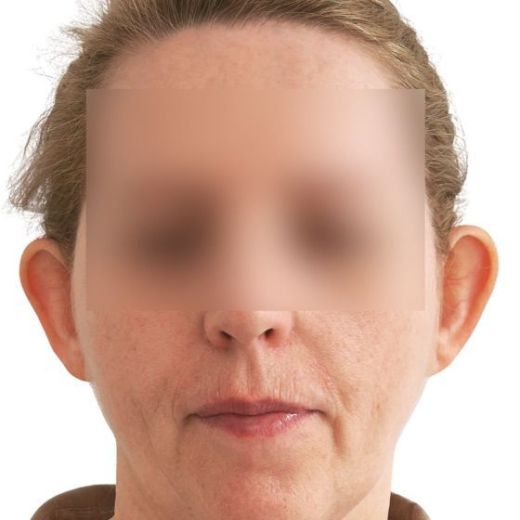 Image before