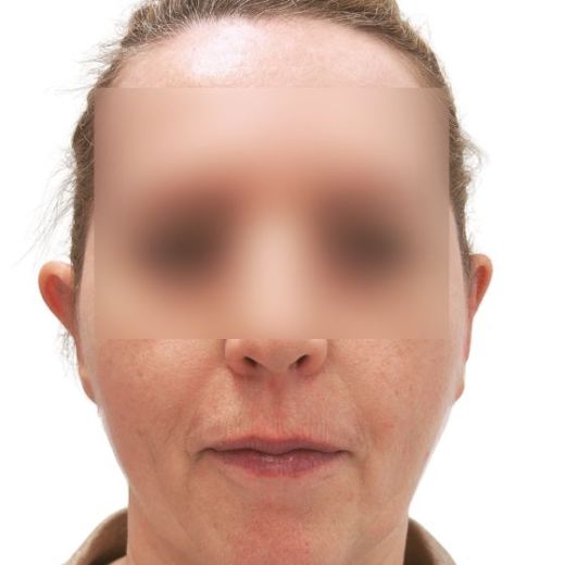 Image after