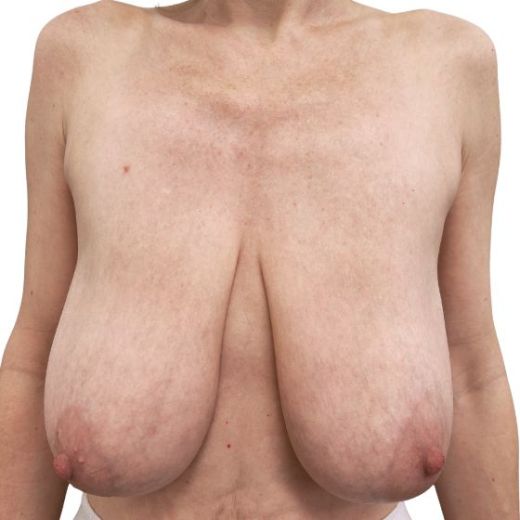Image before